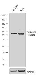 TMEM175 Antibody in Western Blot (WB)