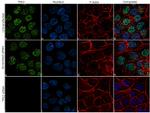 TP63 Antibody in Immunocytochemistry (ICC/IF)