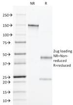 TGF-alpha (Transforming Growth Factor alpha) Antibody in SDS-PAGE (SDS-PAGE)