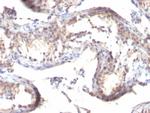 TGF-alpha (Transforming Growth Factor alpha) Antibody in Immunohistochemistry (Paraffin) (IHC (P))