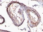 TGF-alpha (Transforming Growth Factor alpha) Antibody in Immunohistochemistry (Paraffin) (IHC (P))