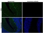 NEFL Antibody in Immunohistochemistry (Paraffin) (IHC (P))