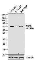 NEFL Antibody in Western Blot (WB)