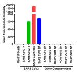 SARS-CoV-2 Spike Protein (RBD) Antibody