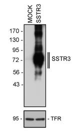 SSTR3 Antibody in Western Blot (WB)