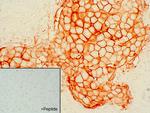 SSTR2 Antibody in Immunohistochemistry (IHC)