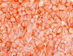 SSTR5 Antibody in Immunohistochemistry (IHC)