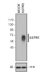 SSTR5 Antibody in Western Blot (WB)