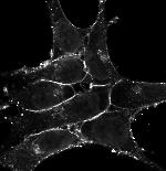 CXCR4 Antibody in Immunocytochemistry (ICC/IF)