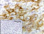 CXCR4 Antibody in Immunohistochemistry (IHC)