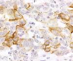 CXCR4 Antibody in Immunohistochemistry (IHC)