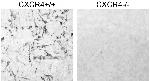 CXCR4 Antibody in Immunohistochemistry (IHC)