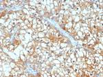 TGFB3/PEIG-1/RAI3/RAIG1/TIG1 Antibody in Immunohistochemistry (Paraffin) (IHC (P))