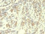 Transglutaminase II (TGM2) Antibody in Immunohistochemistry (Paraffin) (IHC (P))