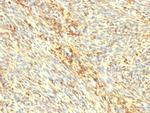 Transglutaminase II (TGM2) Antibody in Immunohistochemistry (Paraffin) (IHC (P))