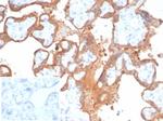 Transglutaminase II (TGM2) (FN Binding Domain) Antibody in Immunohistochemistry (Paraffin) (IHC (P))