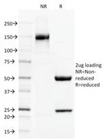 Thrombomodulin/CD141 Antibody in SDS-PAGE (SDS-PAGE)