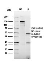 Thrombomodulin/CD141 Antibody in SDS-PAGE (SDS-PAGE)