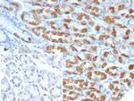 Thrombospondin-1/THBS1 Antibody in Immunohistochemistry (Paraffin) (IHC (P))