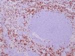 TIA1 (T-Cell-Restricted Intracellular Antigen-1) Antibody in Immunohistochemistry (Paraffin) (IHC (P))