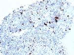 TIA1 (T-Cell-Restricted Intracellular Antigen-1) Antibody in Immunohistochemistry (Paraffin) (IHC (P))