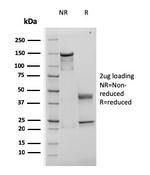 TIMP1 (Colorectal Cancer Biomarker/Marker of Lymph Node Metastasis) Antibody in SDS-PAGE (SDS-PAGE)