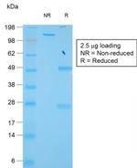 TIMP1 (Colorectal and Lymph Node Metastasis Marker) Antibody in SDS-PAGE (SDS-PAGE)