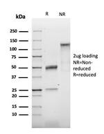 TIMP2 (Tissue Inhibitor of Metalloproteinase 2) Antibody in SDS-PAGE (SDS-PAGE)