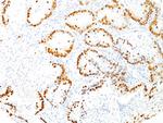 TTF-1/NKX2.1 (Thyroid and Lung Epithelial Marker) Antibody in Immunohistochemistry (Paraffin) (IHC (P))