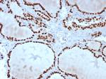 TTF-1/NKX2.1 (Thyroid and Lung Epithelial Marker) Antibody in Immunohistochemistry (Paraffin) (IHC (P))