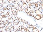 TTF-1/NKX2.1 (Thyroid and Lung Epithelial Marker) Antibody in Immunohistochemistry (Paraffin) (IHC (P))