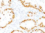 TTF-1/NKX2.1 (Thyroid and Lung Epithelial Marker) Antibody in Immunohistochemistry (Paraffin) (IHC (P))