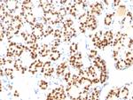 TTF-1/NKX2.1 (Thyroid and Lung Epithelial Marker) Antibody in Immunohistochemistry (Paraffin) (IHC (P))