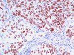 TTF-1/NKX2.1 (Thyroid and Lung Epithelial Marker) Antibody in Immunohistochemistry (Paraffin) (IHC (P))