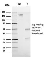 TTF-1/NKX2.1 Antibody in SDS-PAGE (SDS-PAGE)