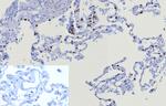 TTF-1/NKX2.1 (Thyroid and Lung Epithelial Marker) Antibody in Immunohistochemistry (Paraffin) (IHC (P))