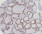 TTF-1/NKX2.1 (Thyroid and Lung Epithelial Marker) Antibody in Immunohistochemistry (Paraffin) (IHC (P))