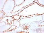 TTF-1/NKX2.1 Antibody in Immunohistochemistry (Paraffin) (IHC (P))