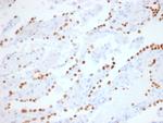 TTF-1/NKX2.1 Antibody in Immunohistochemistry (Paraffin) (IHC (P))