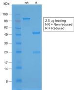 TTF-1/NKX2.1 Antibody in SDS-PAGE (SDS-PAGE)