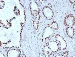 TLE1 (Synovial Sarcoma Marker) Antibody in Immunohistochemistry (Paraffin) (IHC (P))