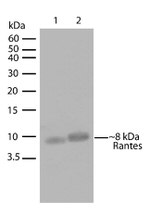 CCL5 (RANTES) Antibody in Western Blot (WB)