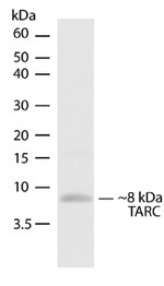 TARC Antibody in Western Blot (WB)