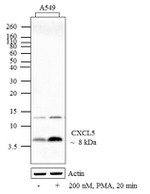 CXCL5 Antibody in Western Blot (WB)