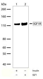 IGF1R beta Antibody in Western Blot (WB)