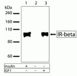 INSR beta Antibody