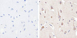 Phospho-PYK2 (Tyr402) Antibody in Immunohistochemistry (Paraffin) (IHC (P))