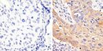 Phospho-STAT3 (Tyr705) Antibody in Immunohistochemistry (Paraffin) (IHC (P))