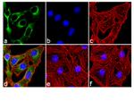 Phospho-INSR (Tyr1158) Antibody in Immunocytochemistry (ICC/IF)