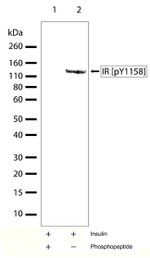 Phospho-INSR (Tyr1158) Antibody in Western Blot (WB)